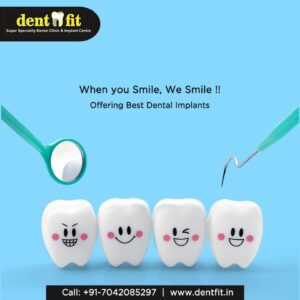 Dentfit-Dental-Implant