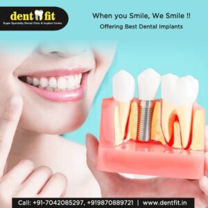 Dentfit-Dental-implant2